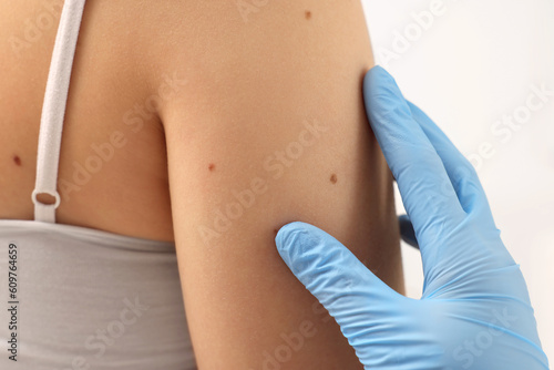 Dermatologist examining patient s birthmark on beige background  closeup