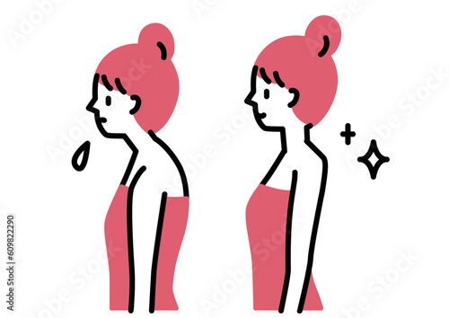 猫背が改善した女性のビフォーアフター