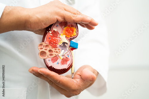 Kidney disease  Chronic kidney disease ckd  Doctor hold model to study and treat in hospital.