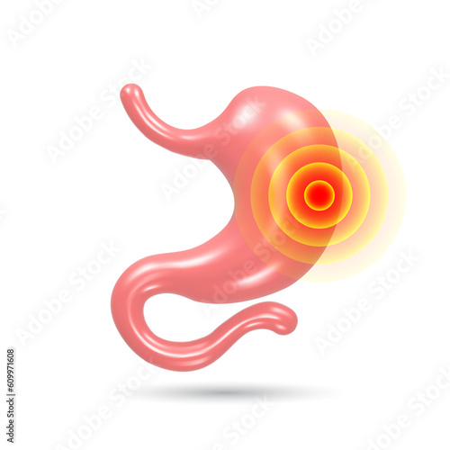 Stomach pain and heartburn. Digestive disease. Gastritis and acid reflux. 3D vector illustration.