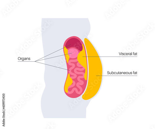 Visceral fat diagram