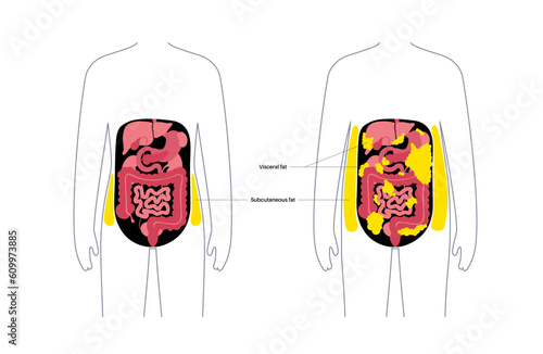 Visceral fat diagram