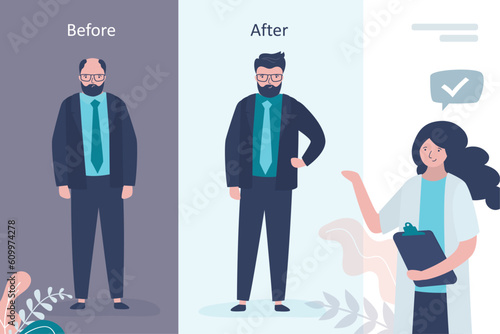 Doctor demonstrate bald man before and after hair transplantation. Handsome guy with hair loss problem, alopecia. Hair transplant surgery. Healthy hair. Head baldness problem solving surgery.