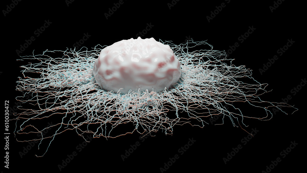 Cancer cell growth uncontrollably over tissue, Tumor infection cells ...