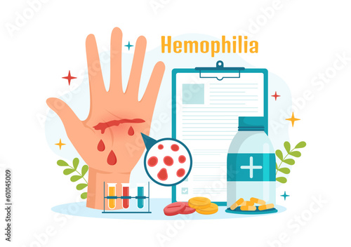Hemophilia Vector Illustration with Doctor Examining Injured Knee or Joint and Blood Disorders in Healthcare Flat Cartoon Hand Drawn Templates