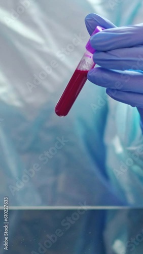 Wallpaper Mural Vertical video. Complete blood count. Diagnostic testing. Microbiology research. Nurse in medical protective gloves studying putting analysis sample tube into container. Torontodigital.ca