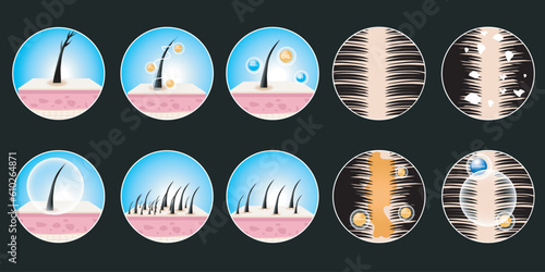vector symbol collection of hair problems, dandruff, hair loss, and oily problems