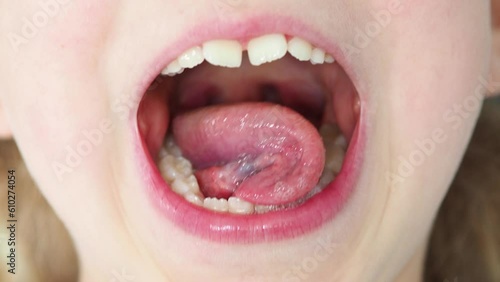Gymnastics for the tongue. Open mouth with inverted tongue. Speech gymnastics at the speech therapist. The lessons of a diffectologist. Facial muscle training. photo