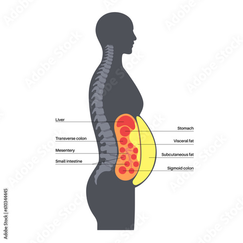 Visceral fat diagram