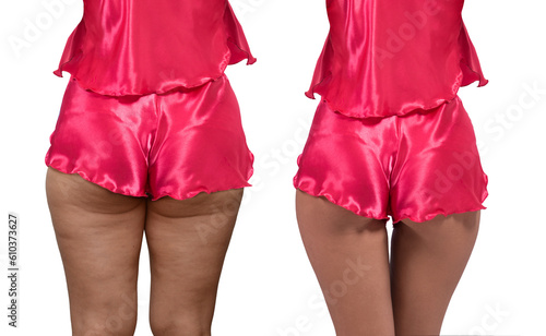 Woman's thighs and buttocks...