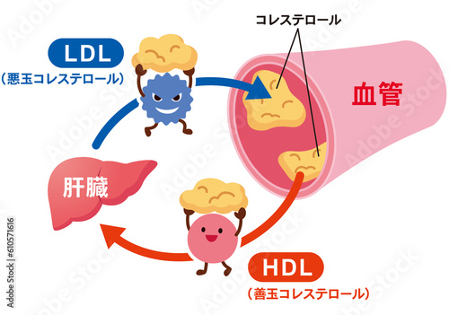LDLとHDLの仕組み　脂質異常症　血管　コレステロール photo