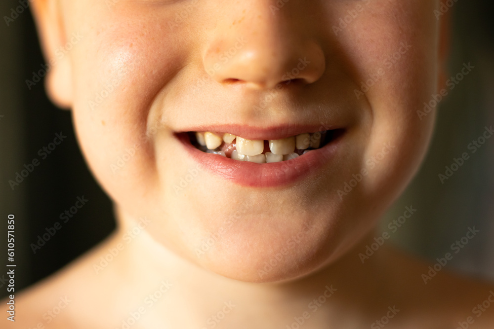 close up of smiling child lost a tooth. Boy portrait without milk upper