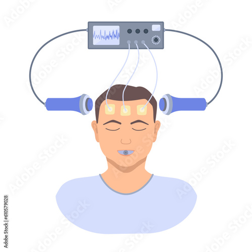 Electroconvulsive therapy for severe depression and schizophrenia treatment. ECT electrodes placement on a male patient. Brain stimulation equipment for major depressive disorders. Vector illustration