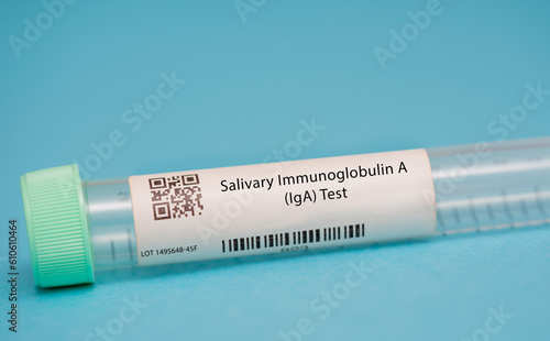 Salivary Immunoglobulin A (IgA) Test