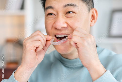Close-up of man wearing orthodontic silicone trainer. Invisible braces aligner.