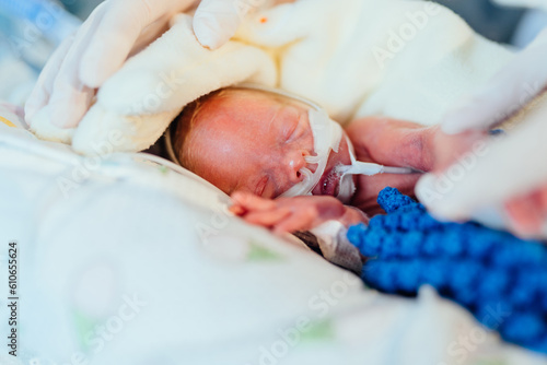 Premature newborn recovering in incubator. Intensive care unit, ventilator for artificial lung ventilation.