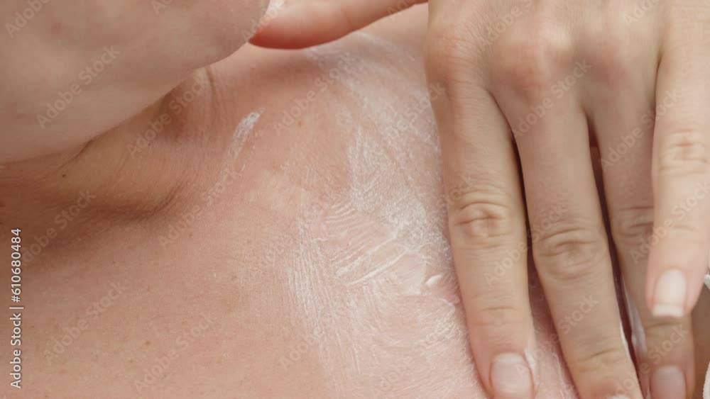 A young woman smears her breasts with sunscreen, she is already red, close-up A young woman smears her breasts with sunscreen, she is already red, close-up