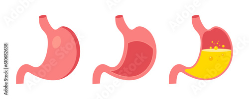 Human stomach. Internal organ, digestive system anatomy, stomach care. Healthy and unhealthy, empty and full human stomach in different style. Nutrition, stomach pain, bloating