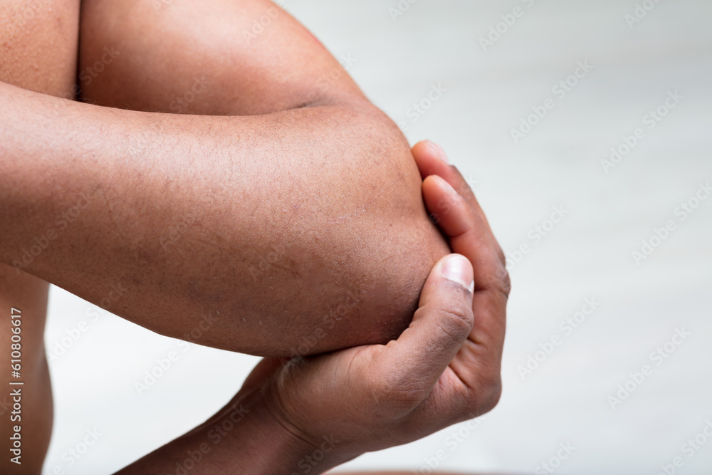 Man holding aching elbow, repetitive strain