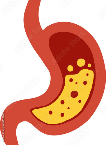Human Stomach with Digestive Acid Organ