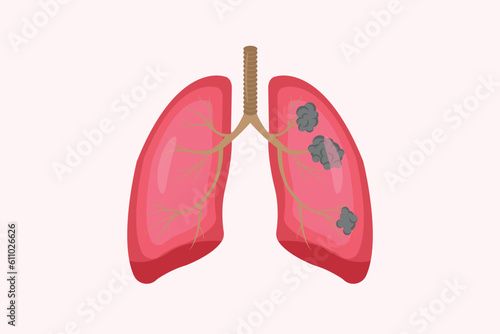 lung cancer and normal lung illustration comparation. eps 10.  icon set