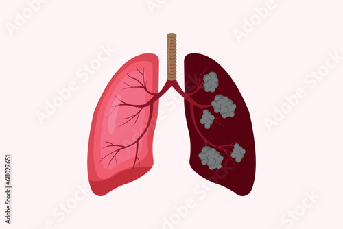 lung cancer and normal lung illustration comparation. eps 10.  icon set