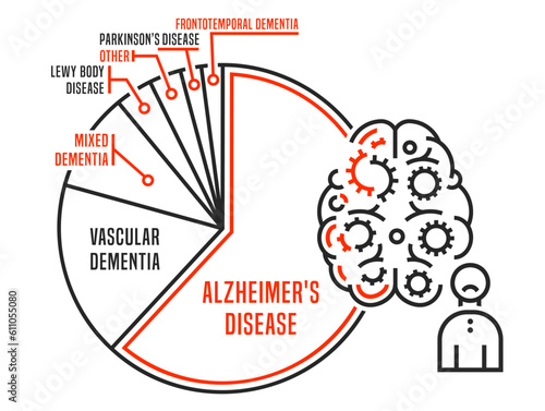 Vector dementia infographic in outline style. Editable illustration