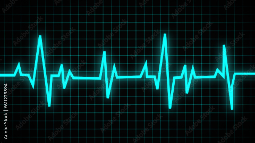 Collection of normal and abnormal ECGs. Vector of an electrocardiogram, ecg, or medical icon. A heartbeat graph