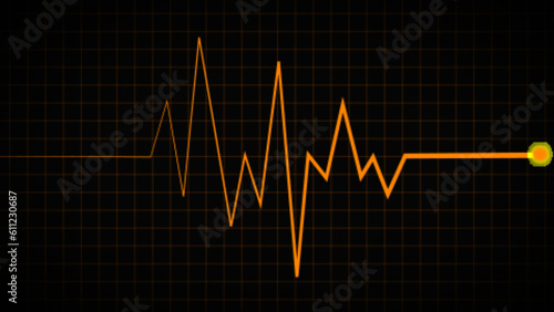 ECG Heartbeat Display, electrocardiogram. Medical history. pulse frequency Line on the screen's green chart backdrop. Heart rate and cardiogram monitor illustration.