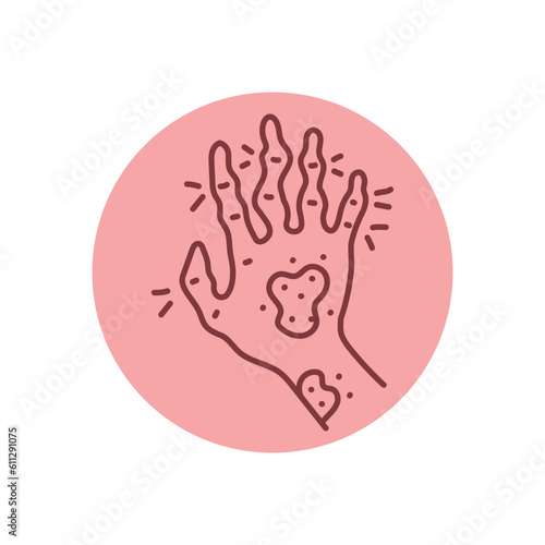 Rheumatoid arthritis black line icon. Autoimmune diseases