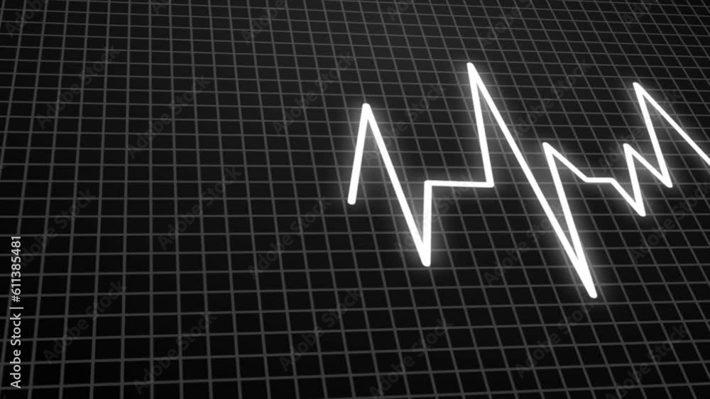Heart rate monitor in the operating room. On the anesthetic surgery