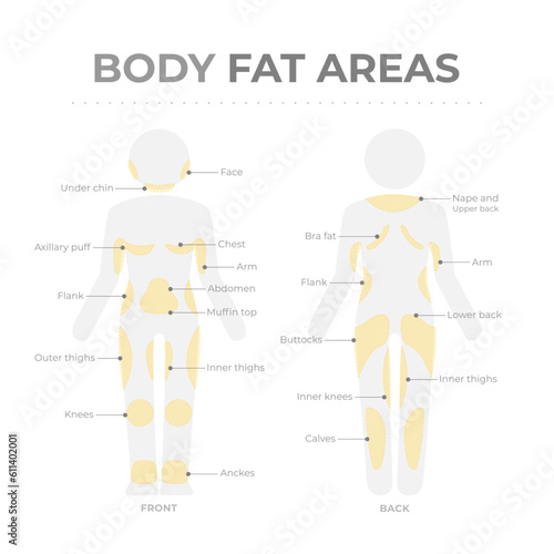 Body fat areas medical poster with fat storage problems. Editable vector infographic of human body pictogram with text and fat deposit areas. Location of adipose tissue in front and back body parts