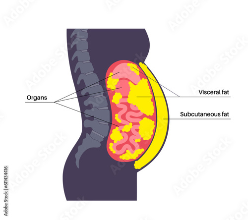 Visceral fat diagram