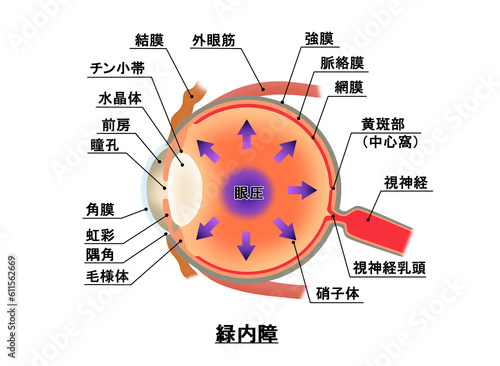 緑内障の仕組み 解説図