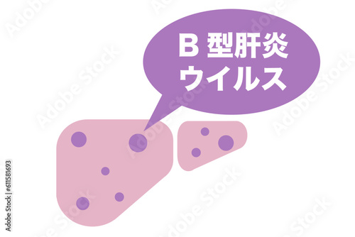B型肝炎ウイルスに感染した肝臓のイラスト