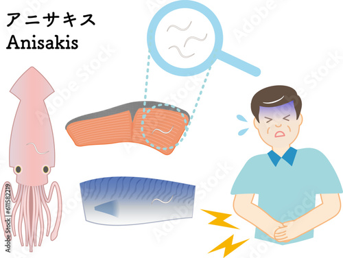 アニサキス（寄生虫）による食中毒のイラストセット
