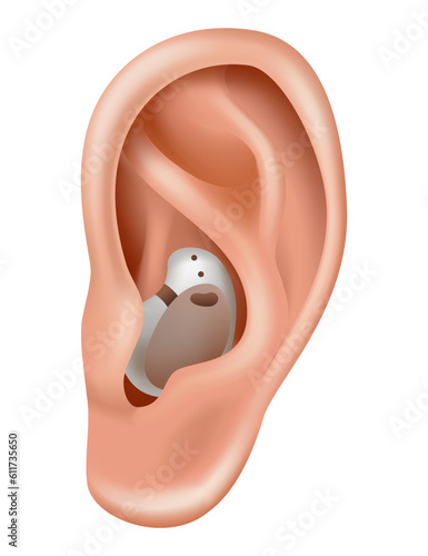 Hearing aid. Sound amplifier for patients with hearing loss. Medicine and health. Realistic object behind the ear. Treatment and prosthetics in otolaryngology