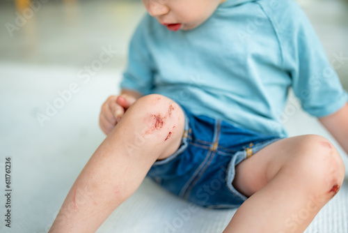 Toddler boy with scraped knees. Parent helping her child perform first aid knee injury after an accident. photo