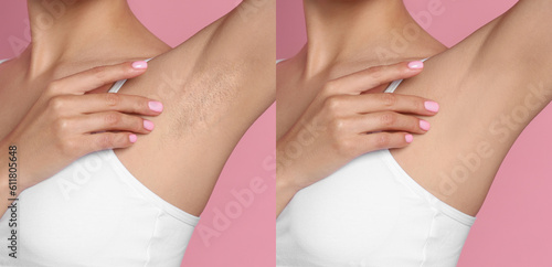 Bild auf Leinwand Before and after epilation
