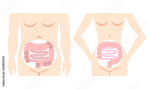 腸スッキリのイメージイラスト