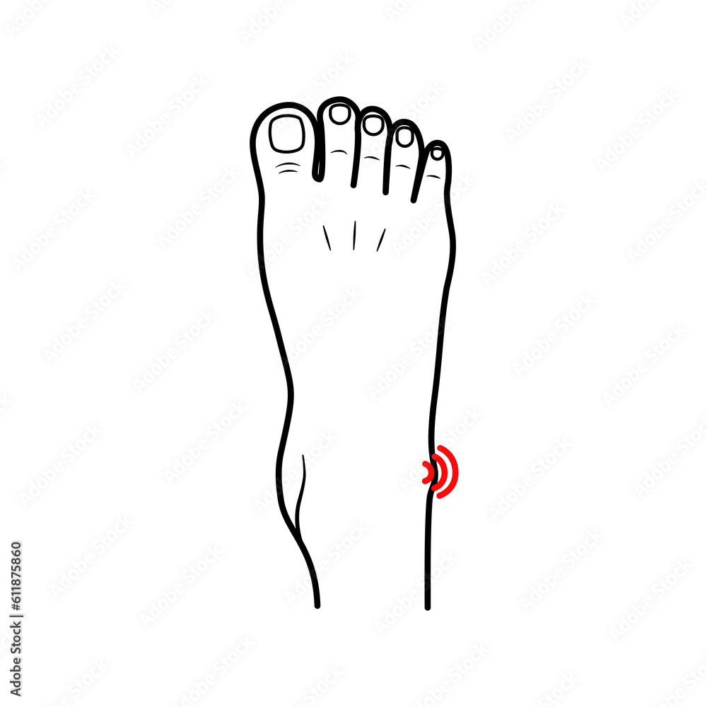 Flat design of healthcare concept pain and injury of the body in the ankle area feeling pain in the feet, ankles. Vector illustration EPS10. Flat design of healthcare concept pain and injury of the body in the ankle area feeling pain in the feet, ankles. Vector illustration EPS10.