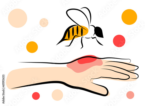 The bee bit the man's hand. Vector illustration in doodle style