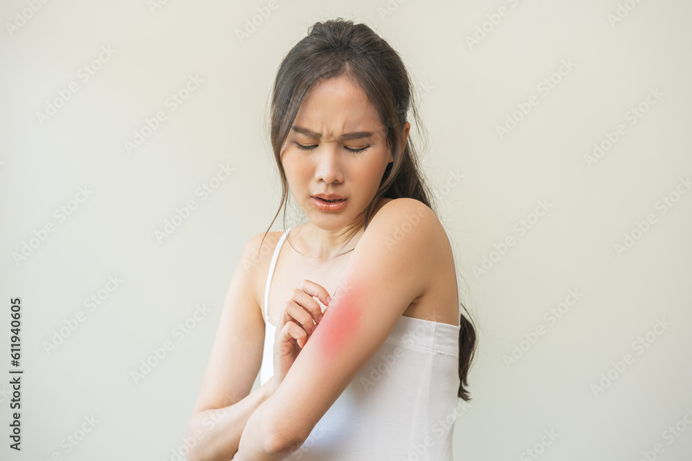 Φωτογραφία Dermatology asian young woman, girl allergy, allergic reaction from atopic, insect bites on her arm, hand in scratching itchy, itch red spot or rash of skin