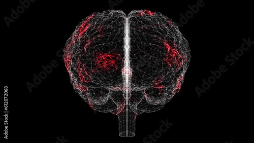 Spread of virus through 3D human brain on black background. Visual demonstration of virus in the body. Tutorial Video. Science Medical concept. 60 FPS 3D animation