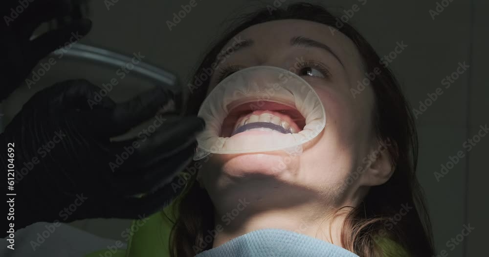 Orthodontist explains how to wear mouth guard after removing braces