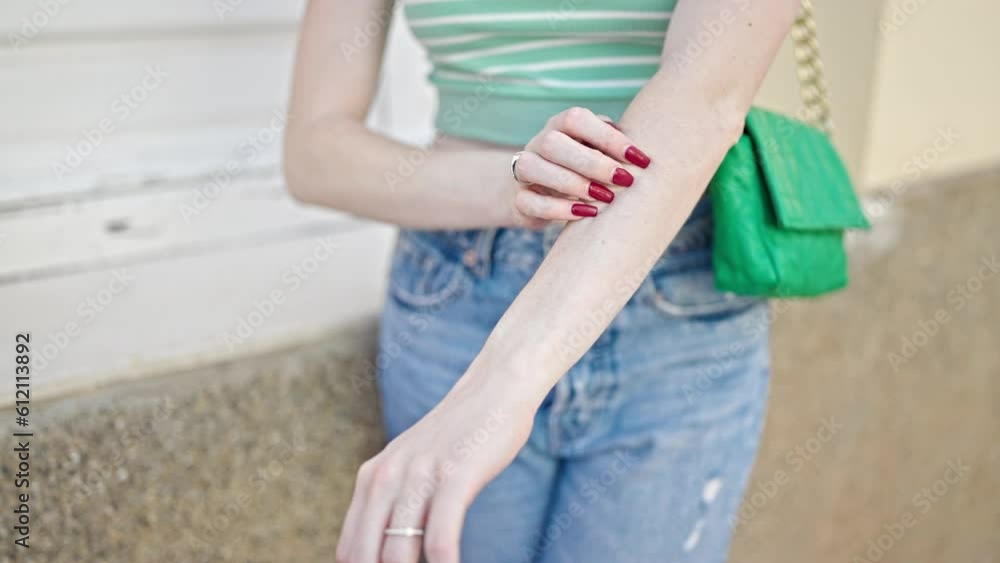 Young blonde woman scratching arms at street Young blonde woman scratching arms at street