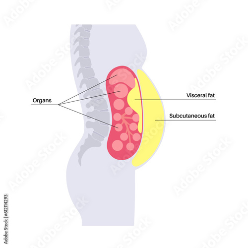 Visceral fat diagram