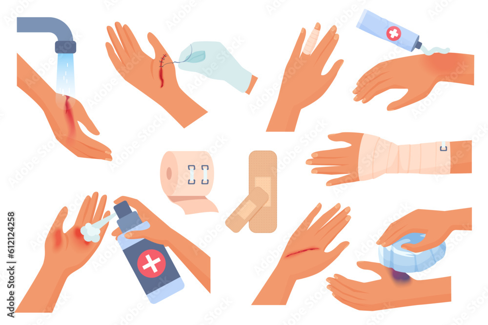 First aid for hand injury set vector illustration. Cartoon isolated injured human arms of patient with wound and burn on skin, hands cleaning trauma with water, using elastic bandage and dressings