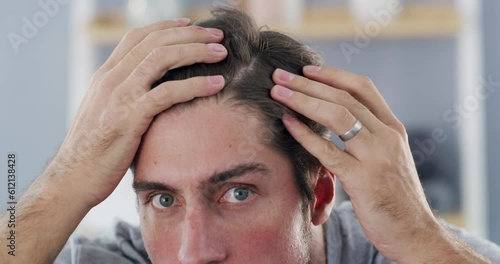 Hair loss, stress and face of man in bathroom with fail, crisis and baldness issue. Hairline, anxiety and portrait of worried male checking head for bald spots, alopecia or scalp, dandruff or problem