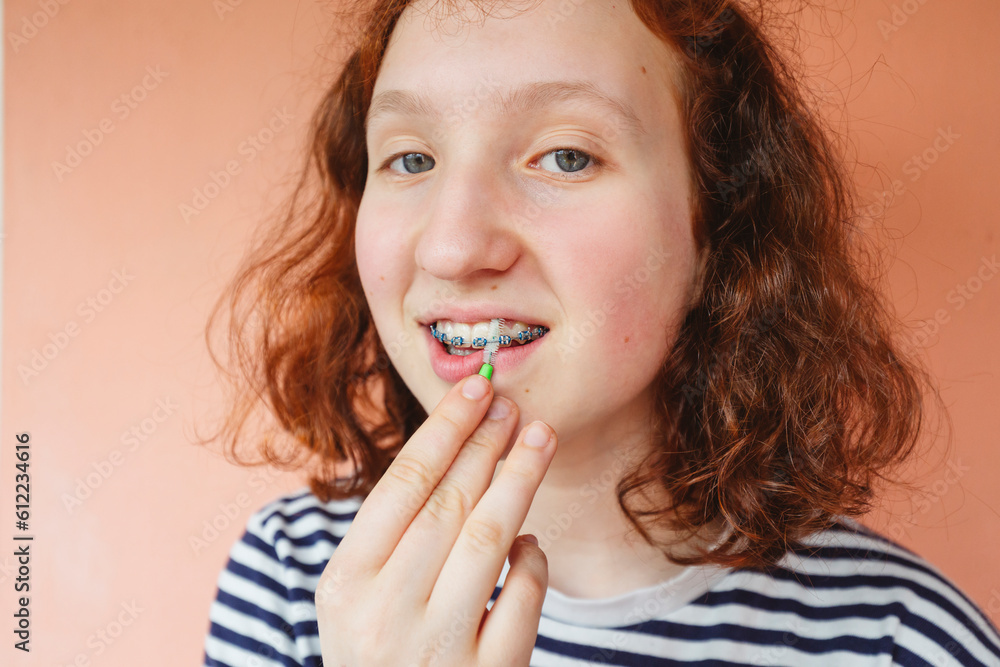Girl cleaning dental braces with interdental brush Girl cleaning dental braces with interdental brush